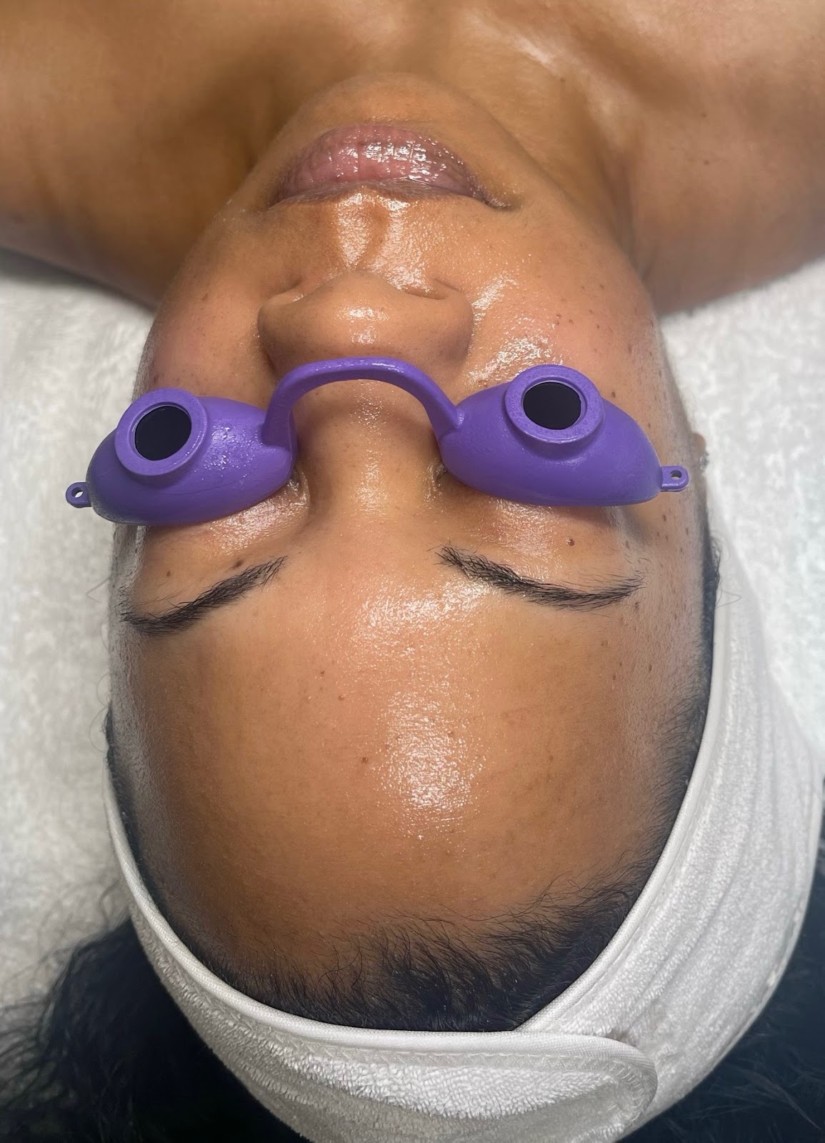 ID13024-Facial
