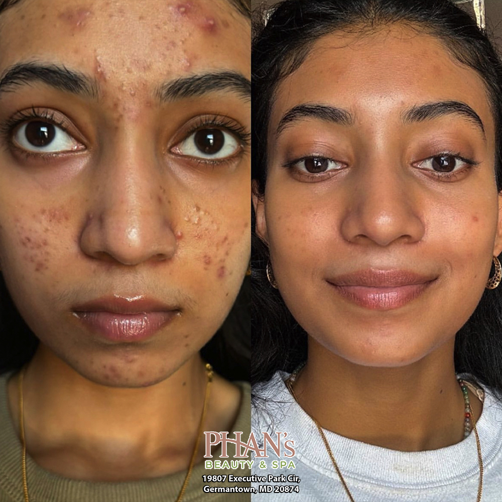 Phans-Beauty-Spa-Germantown-MD-20874