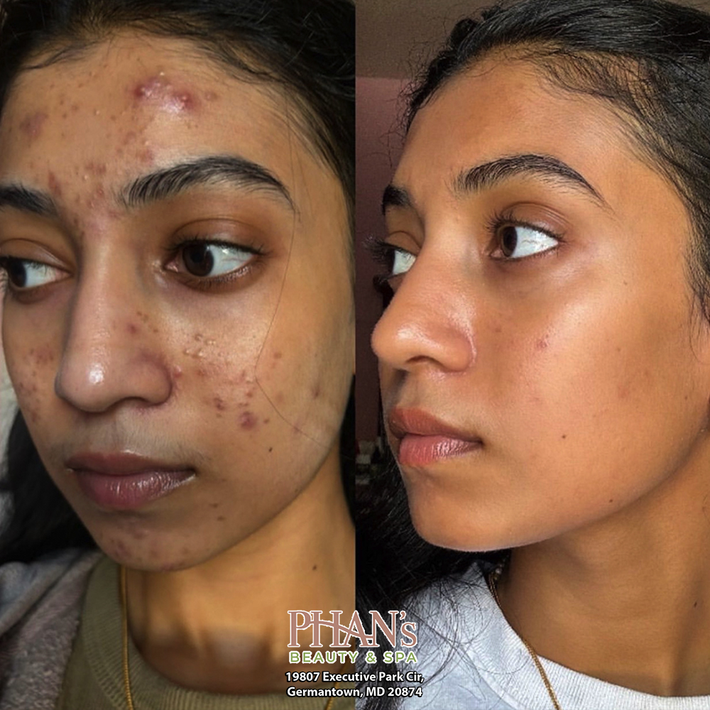 Phans-Beauty-Spa-Germantown-MD-20874