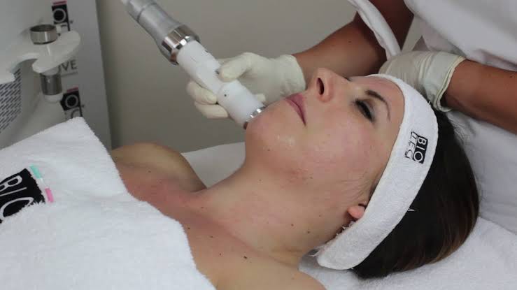 THE RADIANCE FACIAL, THE DELUXE FACIAL, THE AGE REWIND FACIAL, MICRODERMABRASION, CHEMICAL PEEL + LED LIGHT THERAPY