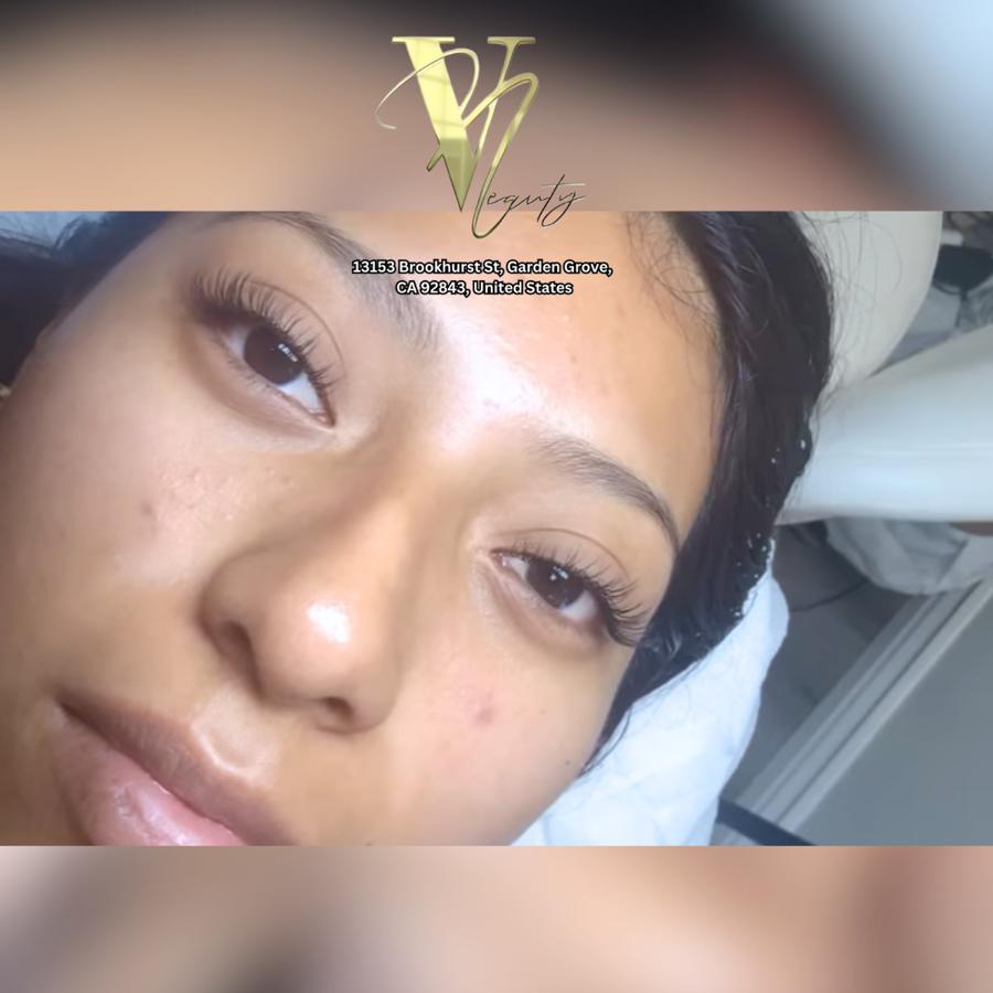 V Beauty