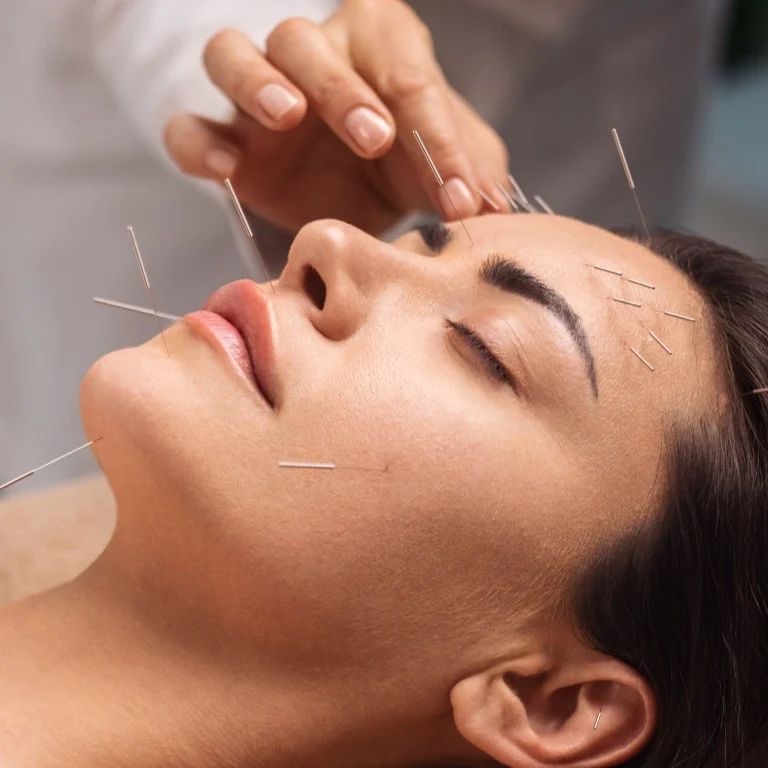 FACIAL ACUPUNCTURE AND HEALTH