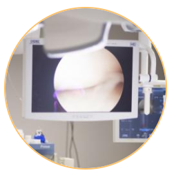 Image Micro Peel Treatment