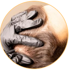 Organic Scalp Pigmentation