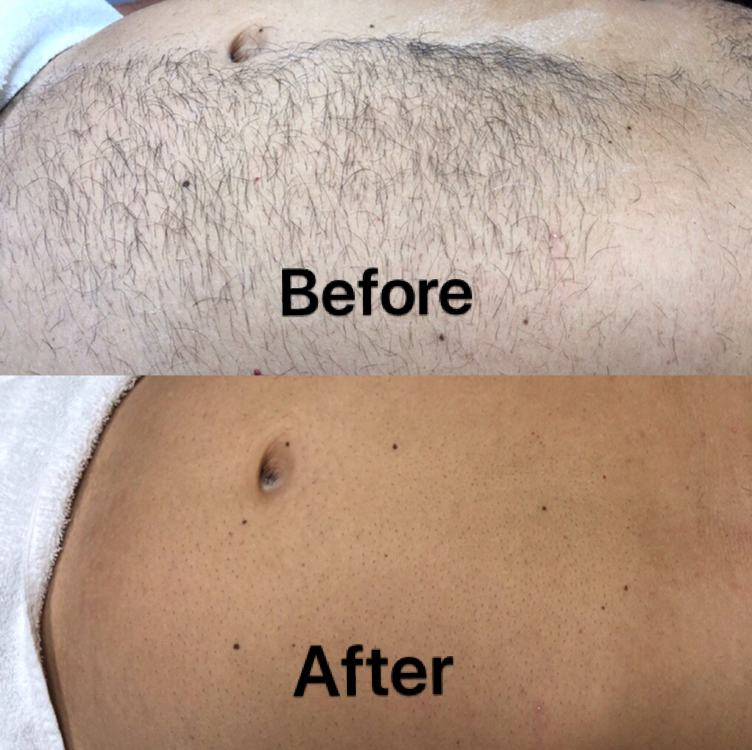 Waxing &amp; Massage