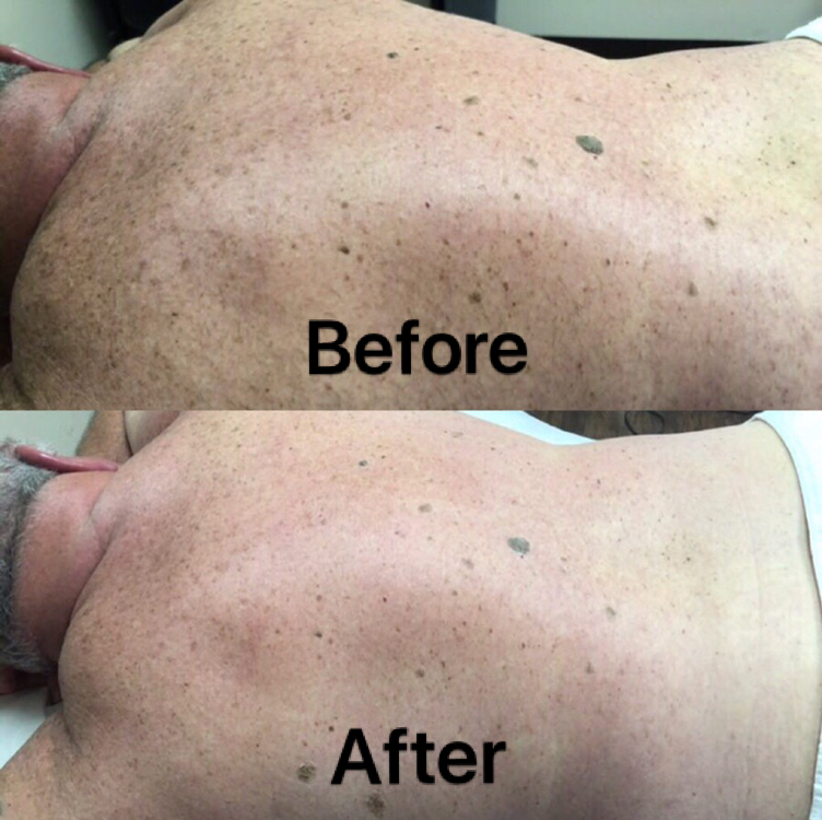 Waxing &amp; Massage