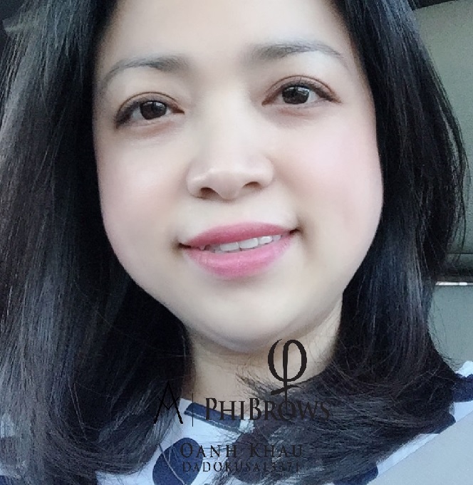 Alt Image