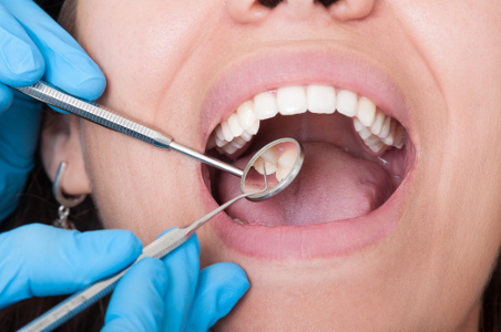 Dental Exam