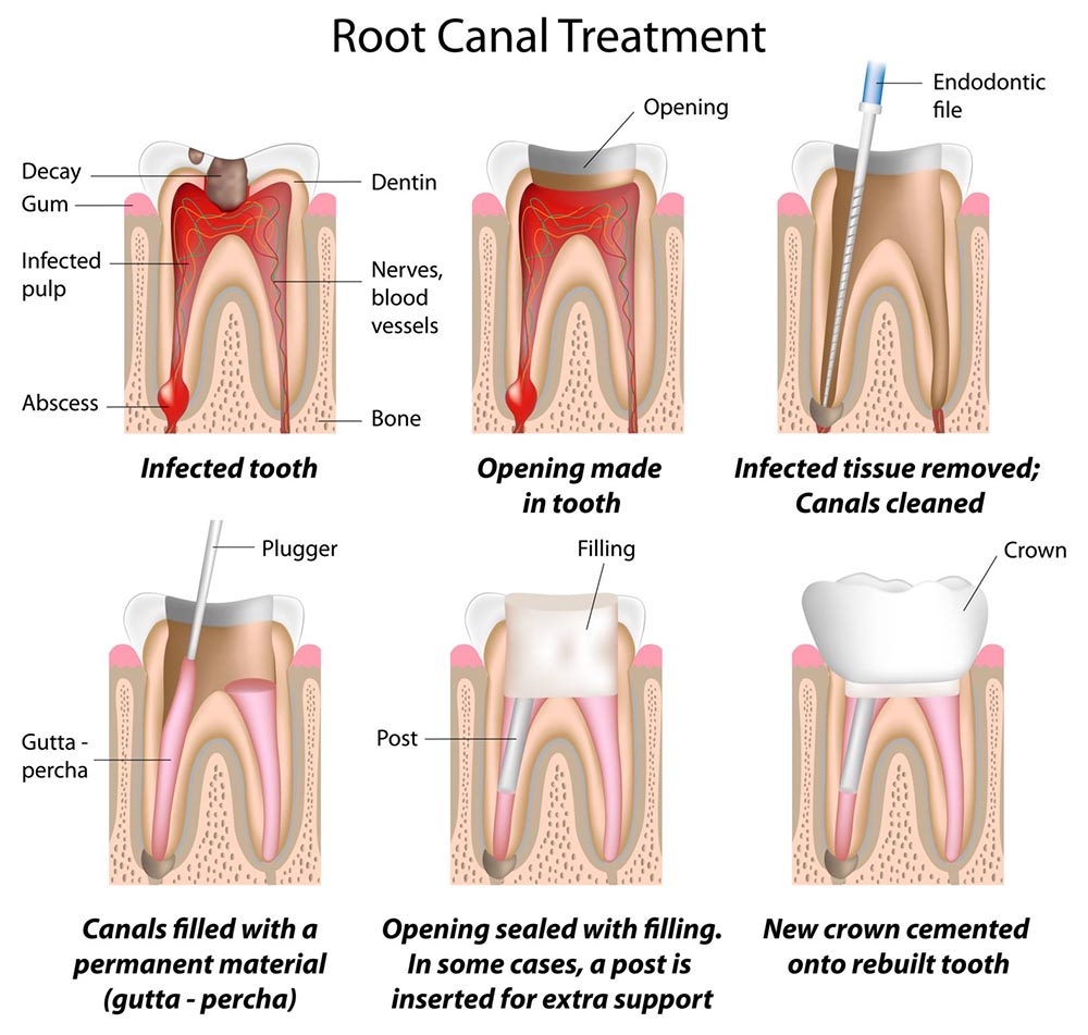 Dental Exam