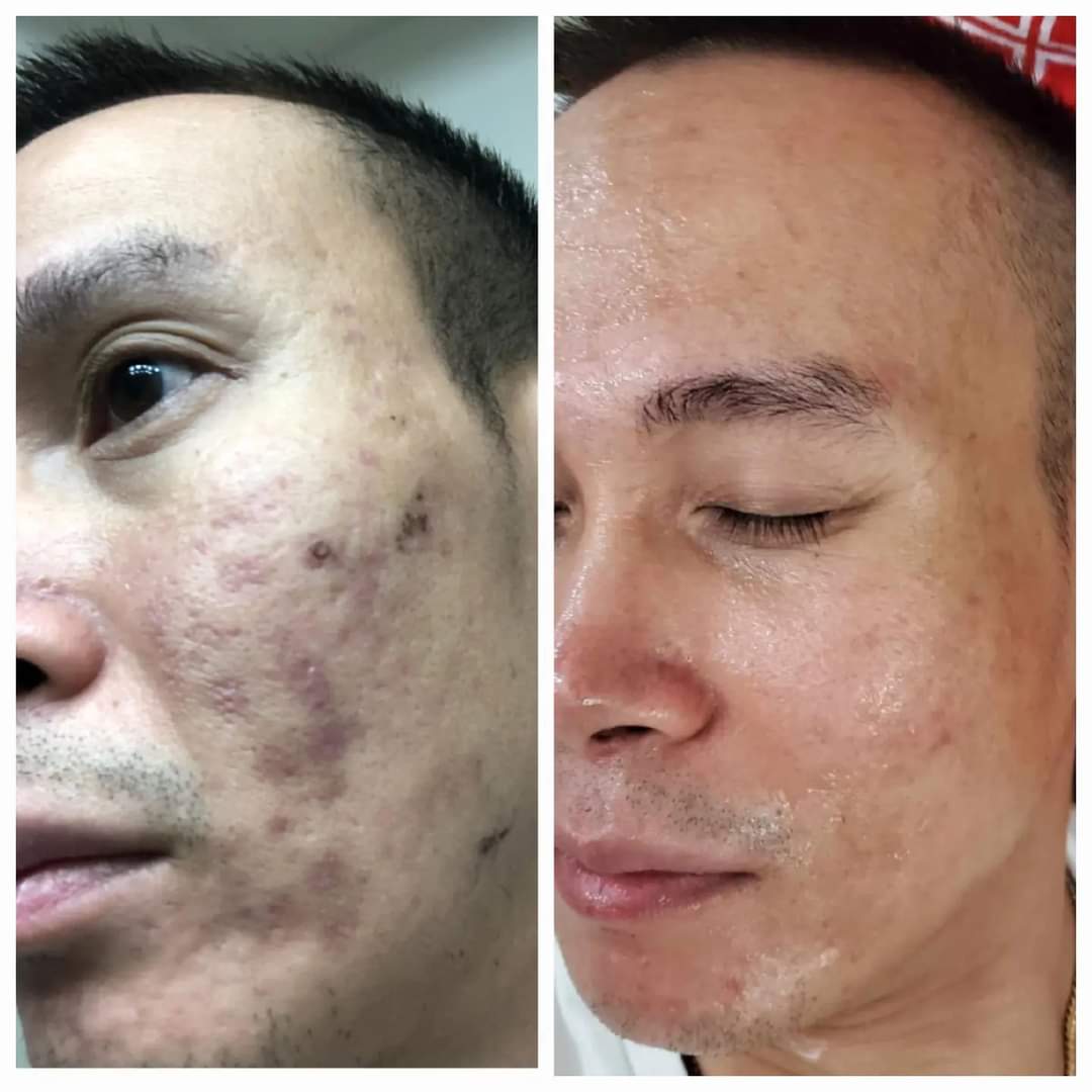 Vk-Beauty-Spa-in-Palm-Beach-Gardens-FL-33403_3